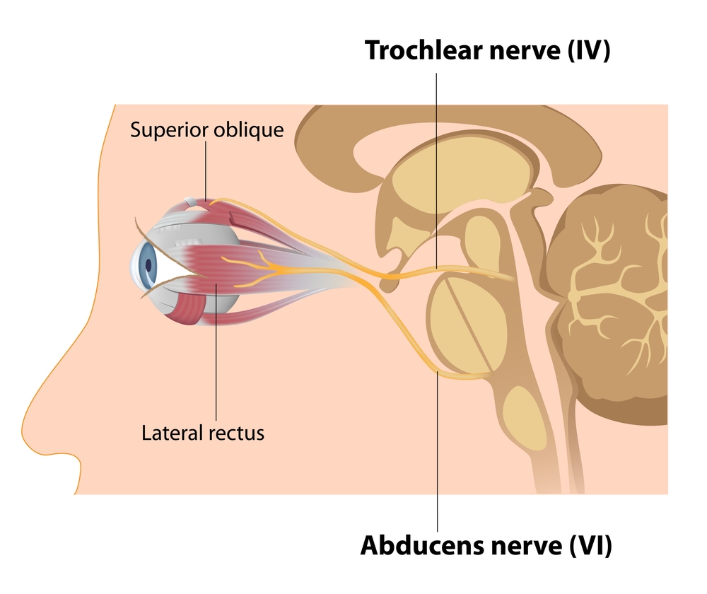 Trochlear and Abducens nerves - Illustration( Alila Medical Media)s