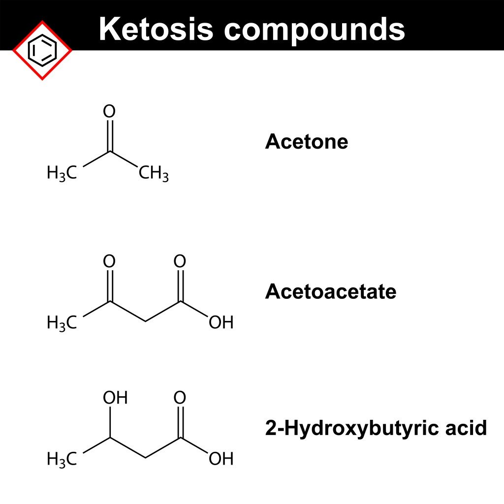Ketone bodies(chromatos)S