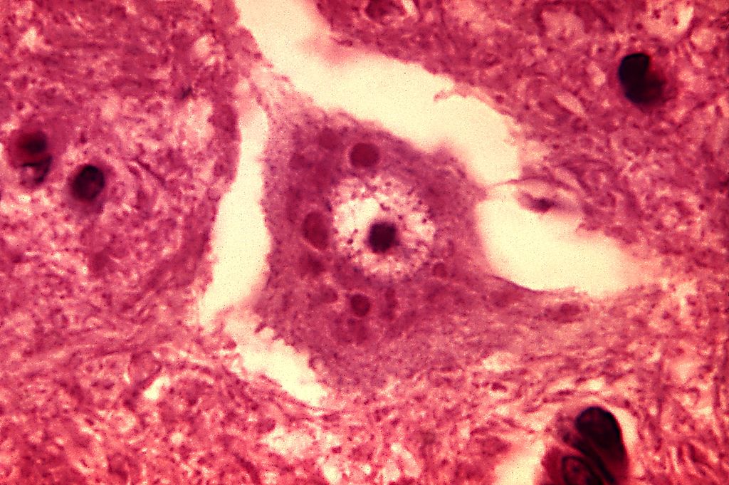 Encefalite da raiva Corpos de Negri PHIL 3377 lores