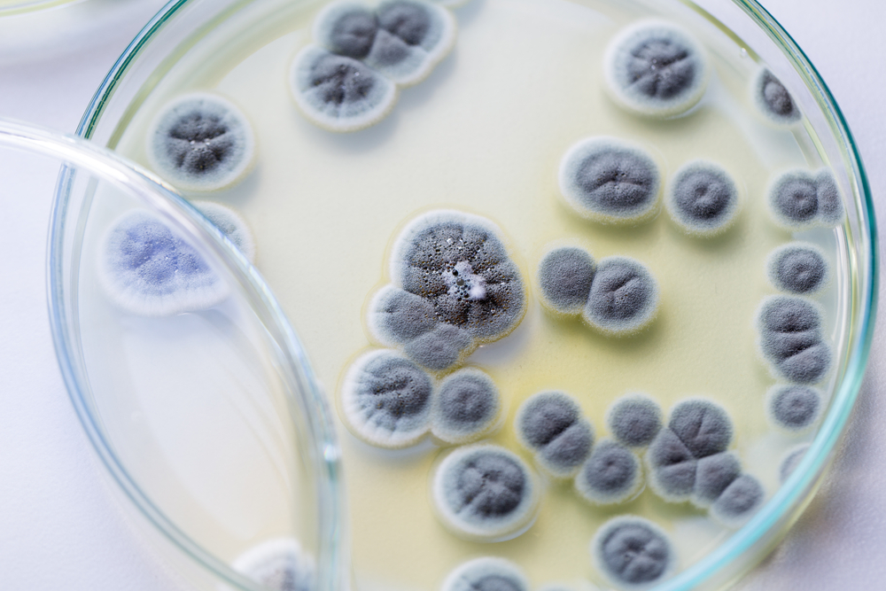 ascomycetous fungi are of major importance in the natural environment as well as food and drug production(Rattiya Thongdumhyu)S