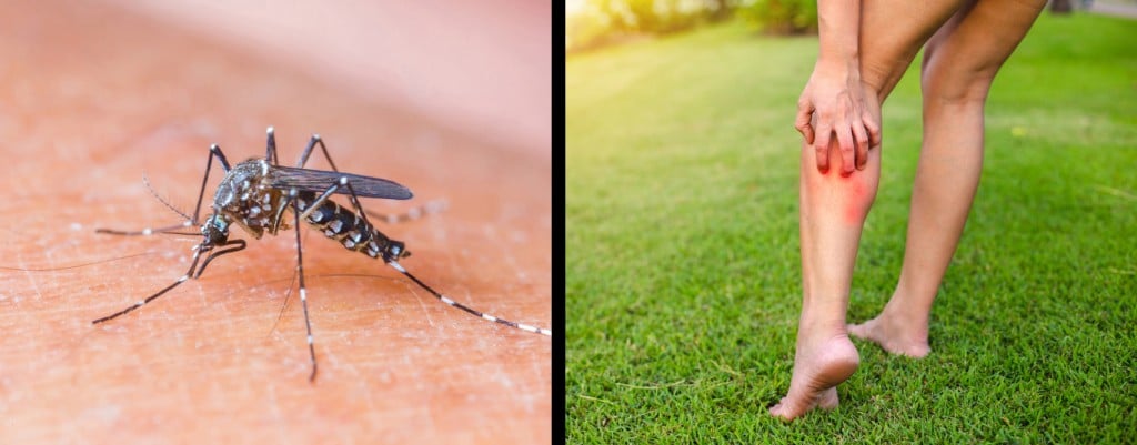 mosquito sucking human blood