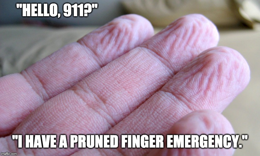 eu tenho um meme de emergência de dedo podado
