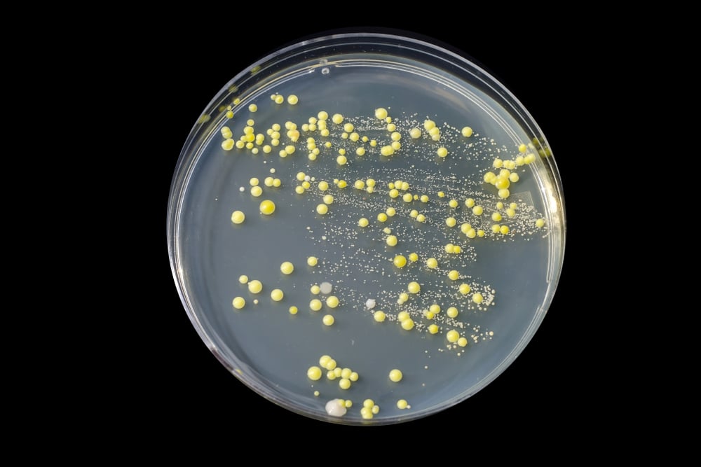 Bactérias cultivadas a partir de esfregaço de pele, colônias de Micrococcus luteus e Staphylococcus epidermidis em placa de Petri (Kateryna Kon) S