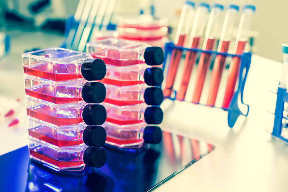 Containers of the biological culture in the laboratory(luchschenF)s