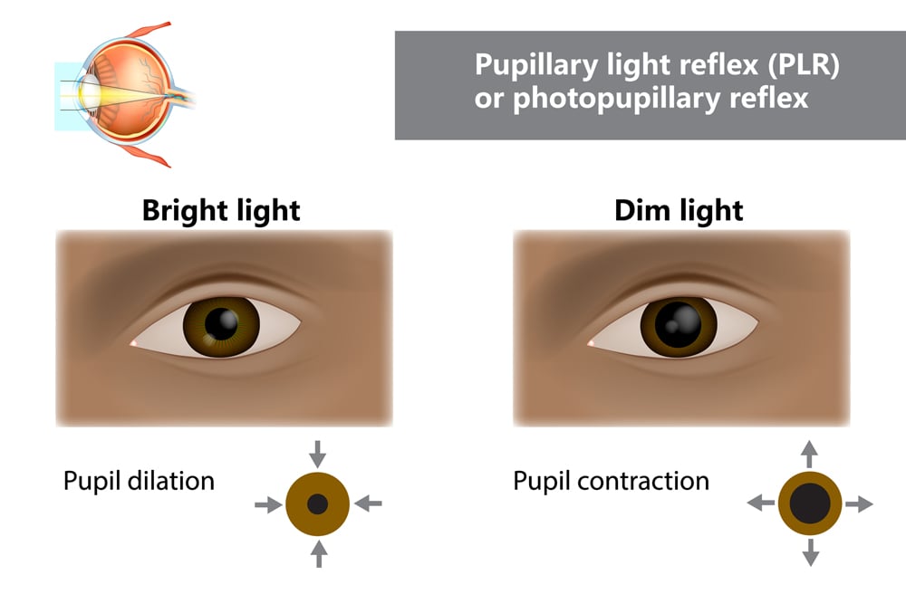 Pupillary light reflex PLR or photopupillary reflex. How do pupils change in size with dim and bright light. Function of Iris and Pupil