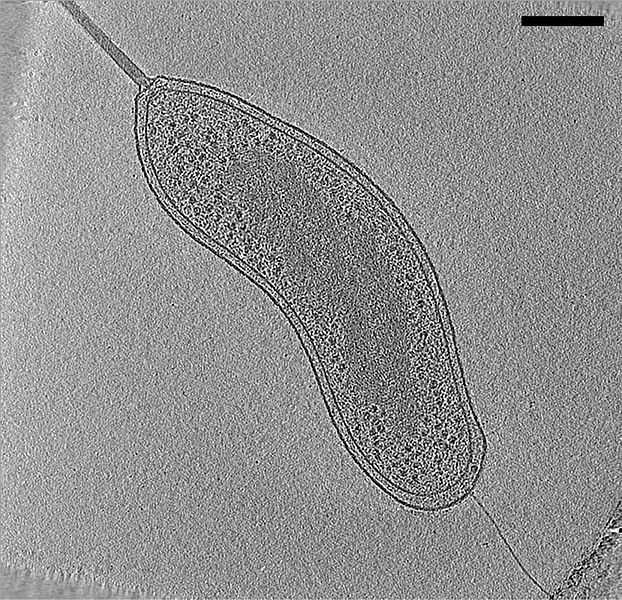 Fatia do criotomograma de elétrons da célula Bdellovibrio bacteriovorus