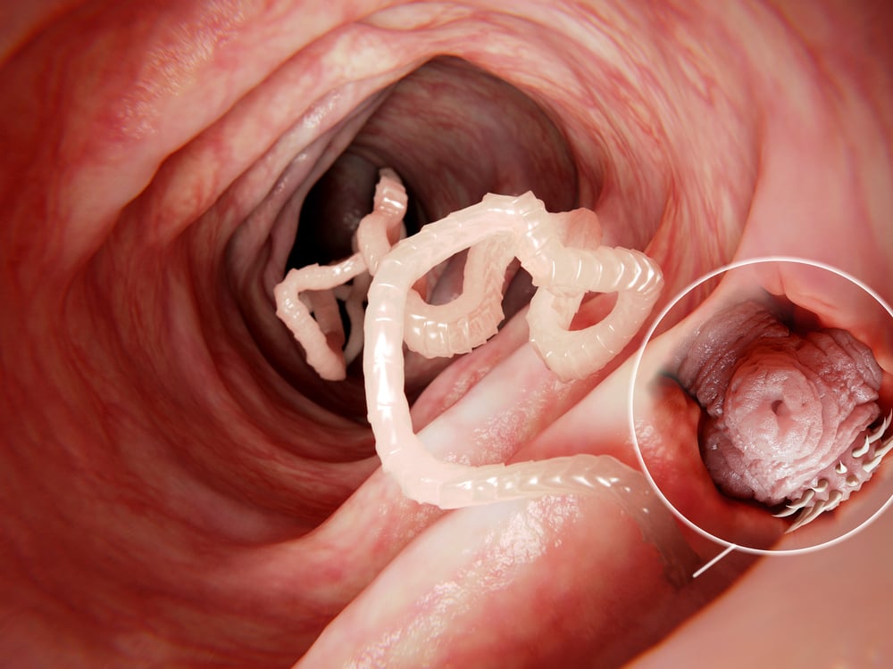 Tapeworm,In,Human,Intestine,,Magnification,Of,The,Head,Attached,To