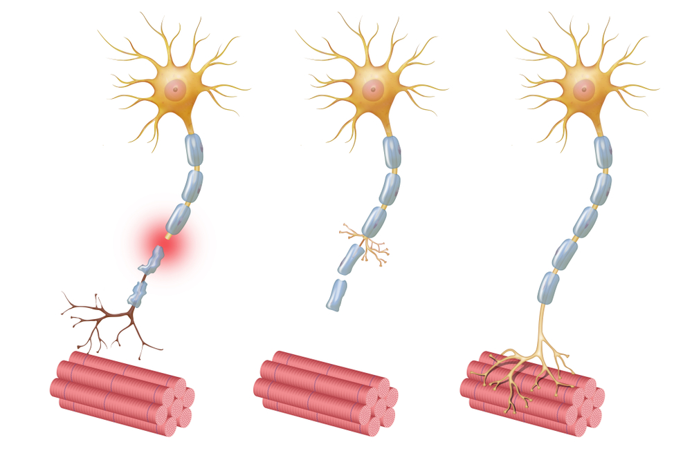 Neuroregeneration,Refers,To,The,Regrowth,Or,Repair,Of,Nervous,Tissues,