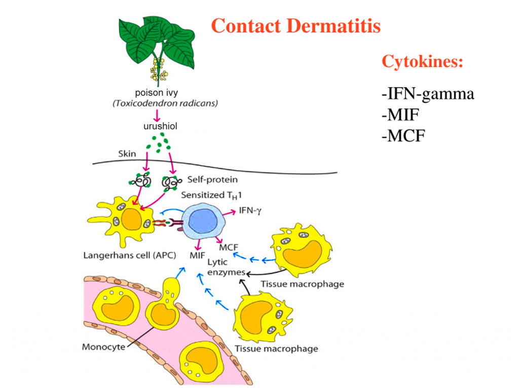 The delayed type hypersensitivity reaction