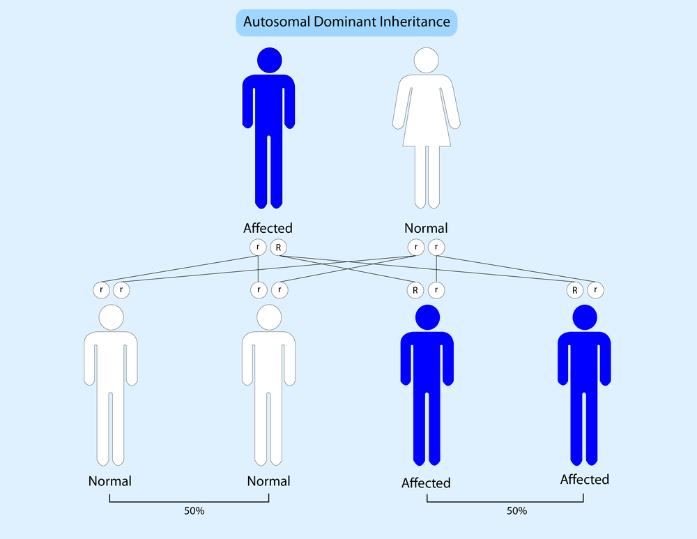 Autosomal,Dominant,Inheritance