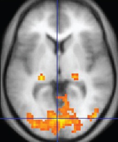 FMRI