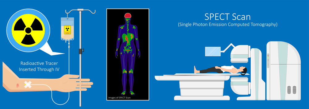 SPECT scan radiologist single computed image CT PET 3D radiotracer Radioiodine I-131 examines uptake treat iodine radiology radioactive diagnosis diagnose radioisotopes radiopharmaceuticals