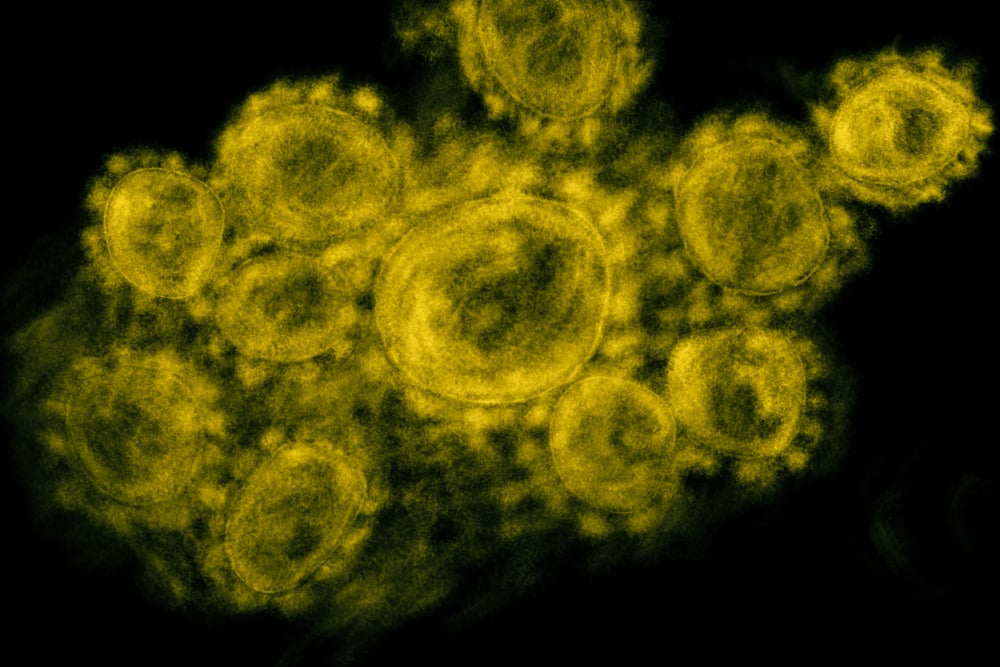 Microscope,Image,Shows,The,Coronavirus,,Sars-cov-2,,Coronavirus,2019,(covid,19)