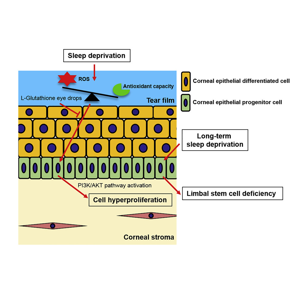 How sleep deprivation damages the cornea.