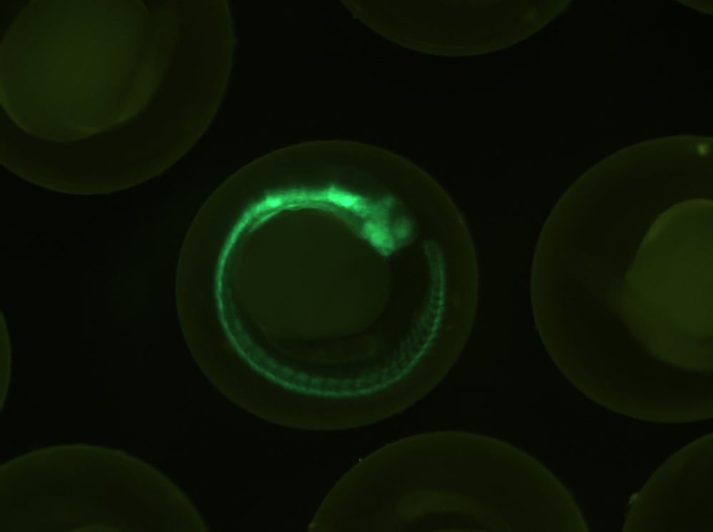 Transgenic,Zebrafish,,Gfp