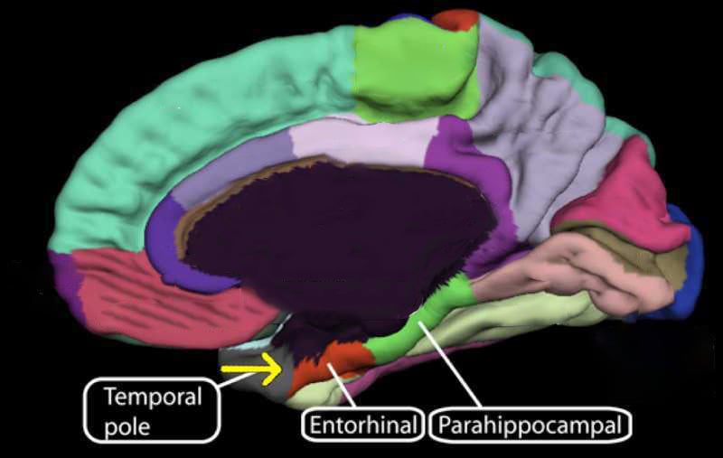Medial-surface-of-cerebral-cortex