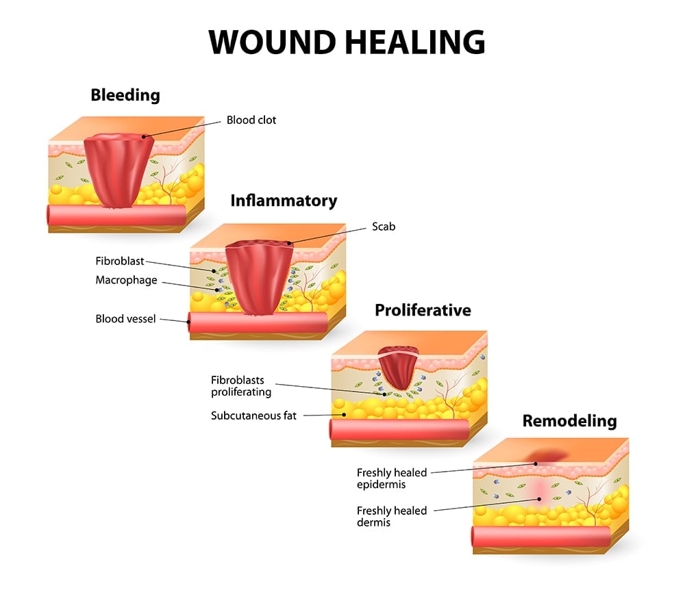 Frontiers  A Scarless Healing Tale: Comparing Homeostasis and Wound  Healing of Oral Mucosa With Skin and Oesophagus