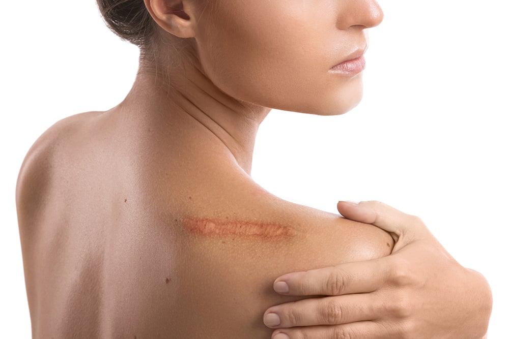 Frontiers A Scarless Healing Tale: Comparing Homeostasis and Wound Healing of Oral Mucosa With Skin and Oesophagus